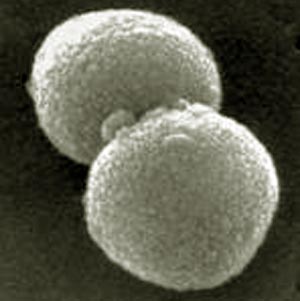 Streptococcusok és rossz lehelet